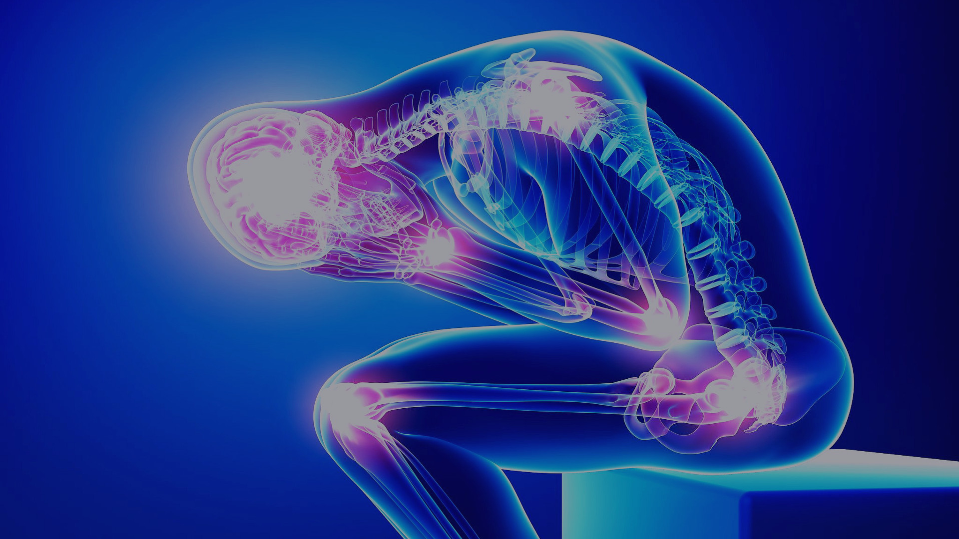 Myofascial pain syndrome: Fibromyalgia